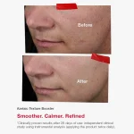 SKINCODE Azelaic Texture Booster